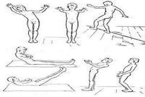 Лечение атаксии