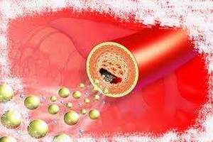 Атеросклероз сосудов