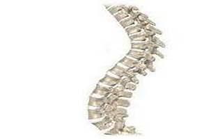 Лечение кифоза