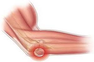 Лечение фиксационных и рубцовых контрактур массажем