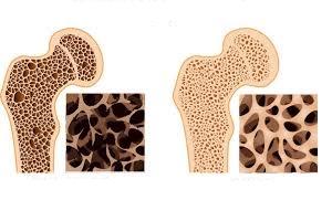 Костная ткань