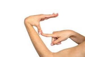 Синдром Элерса-Данлоса