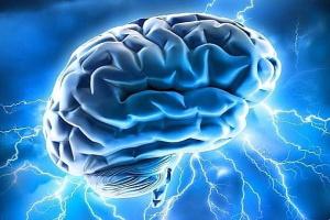 Нейрокинезиология